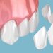 Dental Hygienists: Crafting Personalised Care for Optimal Oral Health