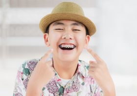 Veneers: Pioneering a New Era of Dental Minimalism