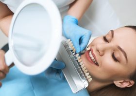 Veneers: Crafting Timeless Smiles with Artistic Precision